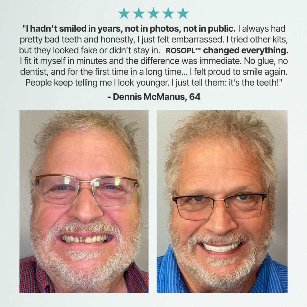 ROSOPLTM Custom-Fit Full Functional Dentures – 70% Off! 👍 Edison Award Winner, 96% Secure Fit Rate
