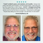 ROSOPLTM Custom-Fit Full Functional Dentures – 70% Off! 👍 Edison Award Winner, 96% Secure Fit Rate
