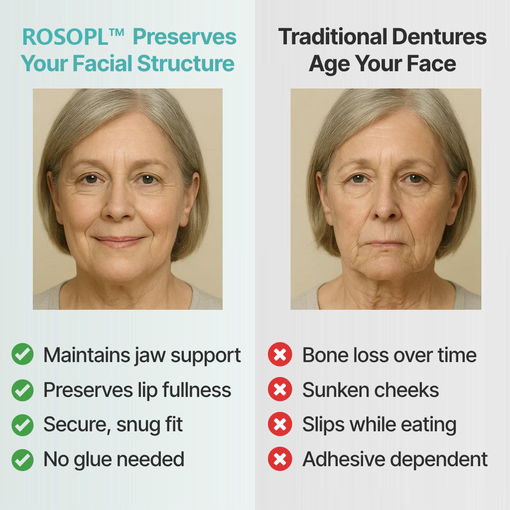ROSOPLTM Custom-Fit Full Functional Dentures – 70% Off! 👍 Edison Award Winner, 96% Secure Fit Rate
