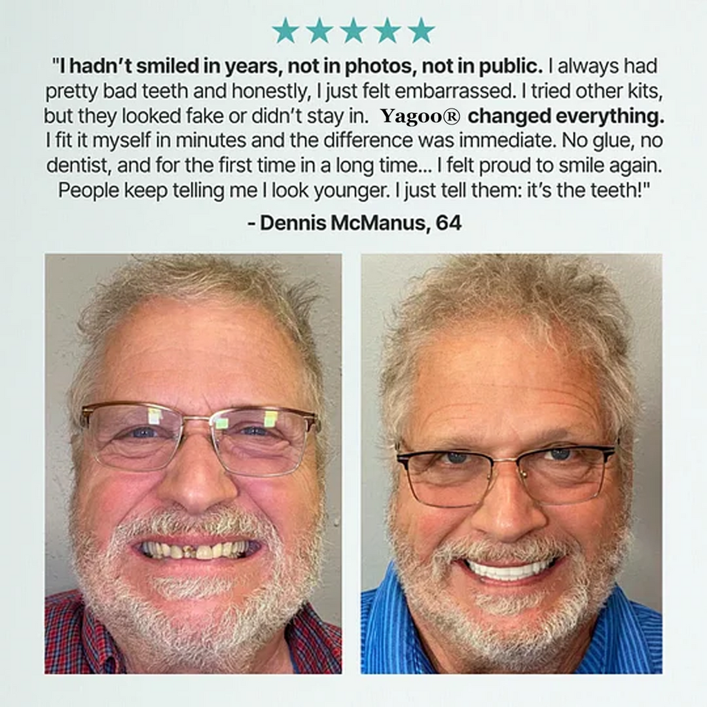 🔥BLACK FRIDAY SALE Ends Today: 70% OFF! ROSOPLTM Custom-Fit Full Functional Dentures