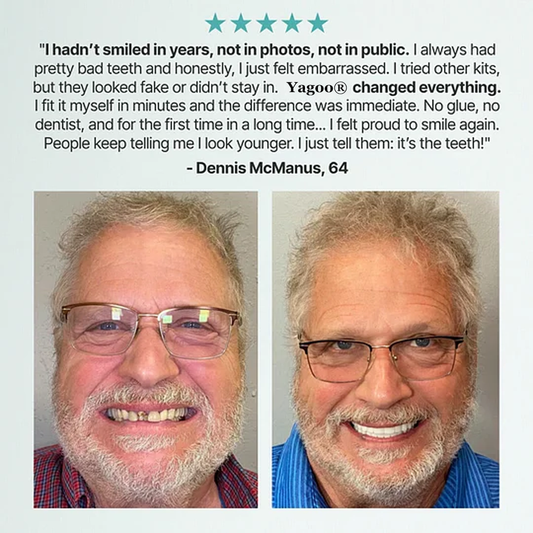 🔥BLACK FRIDAY SALE Ends Today: 70% OFF! ROSOPLTM Custom-Fit Full Functional Dentures