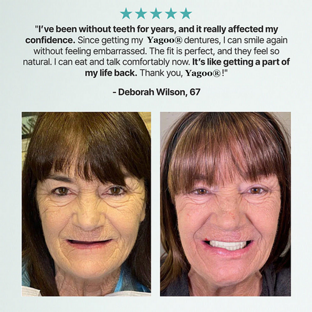 🔥BLACK FRIDAY SALE Ends Today: 70% OFF! ROSOPLTM Custom-Fit Full Functional Dentures