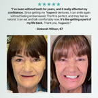 🔥BLACK FRIDAY SALE Ends Today: 70% OFF! ROSOPLTM Custom-Fit Full Functional Dentures