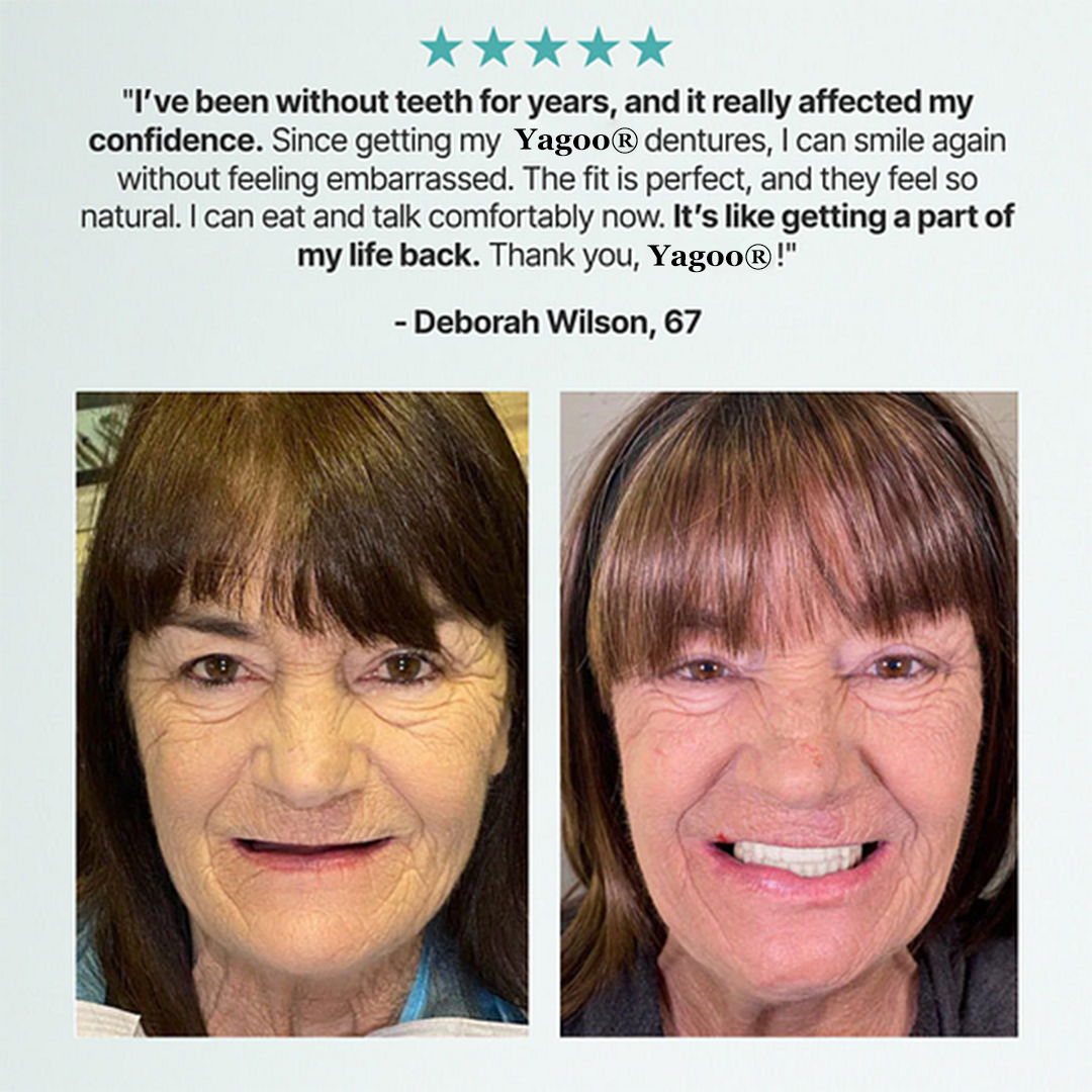 🔥BLACK FRIDAY SALE Ends Today: 70% OFF! ROSOPLTM Custom-Fit Full Functional Dentures