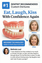 🔥BLACK FRIDAY SALE Ends Today: 70% OFF! ROSOPLTM Custom-Fit Full Functional Dentures