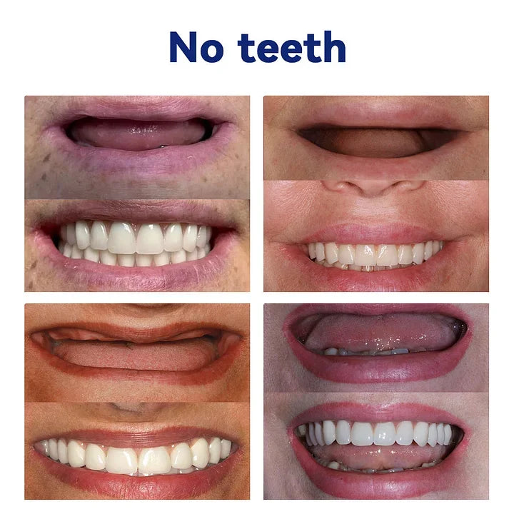 🔥YUNPSOTM New 72-Hour Denture Sale! 45% off + Free Ultrasonic Cleaner