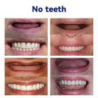🔥YUNPSOTM New 72-Hour Denture Sale! 45% off + Free Ultrasonic Cleaner